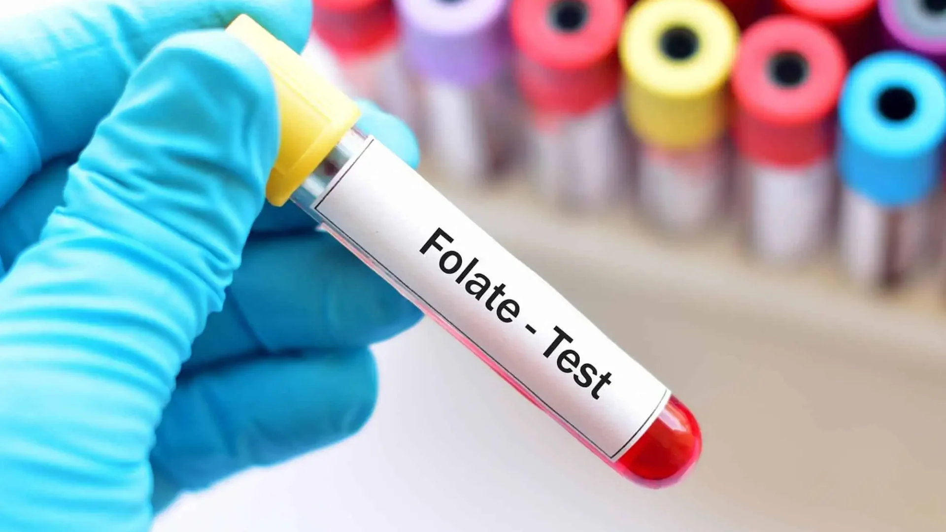 Folic Acid